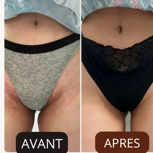 Intérieur des cuisses et zone du bikini foncés