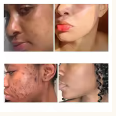Coffret de soins  à l'acide kojique